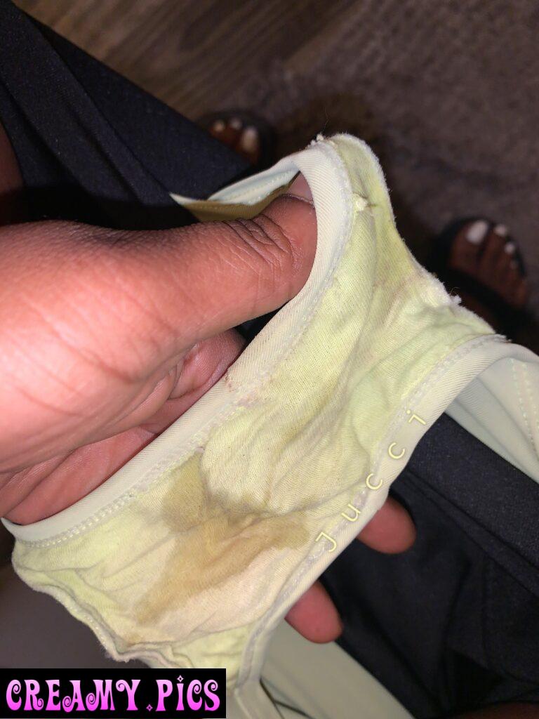 Whoops I coughed too hard & peed a little 🙈 it looks like an ovary to me lol wby?